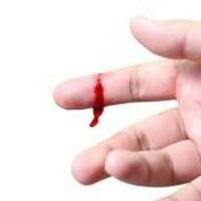 Von Willebrand Disorder