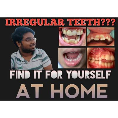 IRREGULAR TEETH???....DONT WORRY!!!...........