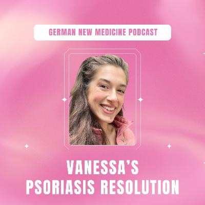 Interview with Vanessa: Psoriasis Resolution