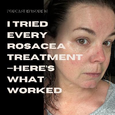 #10: I Tried Every Rosacea Treatment—Here’s What Finally Worked