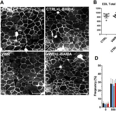 Exercise and L-BAIBA Supplement Boost Muscle and Bone Health in Aging Mice