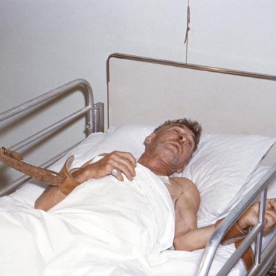 Human Rabies Cases: How It Kills and Who Survived Human Rabies Cases: How It Kills and Who Survived