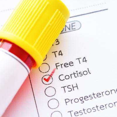 Dosagem de Cortisol
