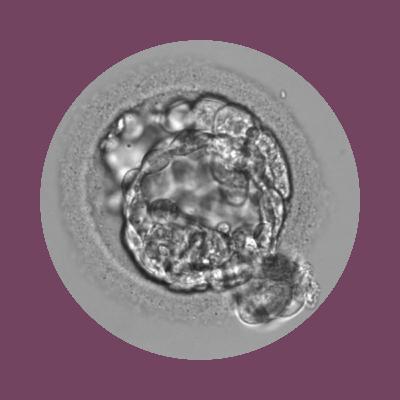 Navigating Canada's fertility industry
