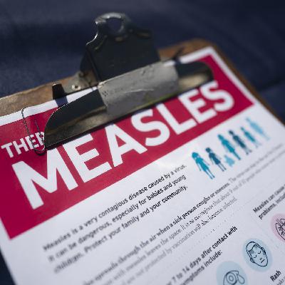 Measles is surging in the U.S. Here’s why — and where.