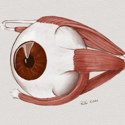 Samtal om samsyn - när ögats muskler inte lirar som de ska