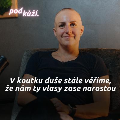 Máma s alopecií: Přišla jsem si i hezčí úplně bez těch vlasů, než když mi něco málo roste Máma s alopecií: Přišla jsem si i hezčí úplně bez těch vlasů, než když mi něco málo roste