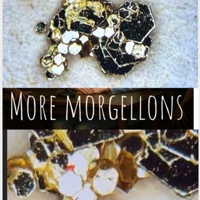 Morgellons Worms