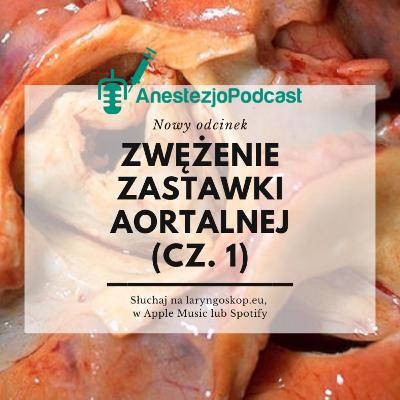 Odcinek 90 - Zwężenie zastawki aortalnej (cz. 1) Odcinek 90 - Zwężenie zastawki aortalnej (cz. 1)