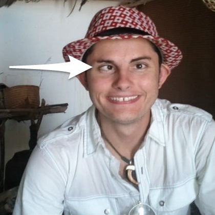 Do Smart Drugs make you Cross Eyed or cause Strabismus?