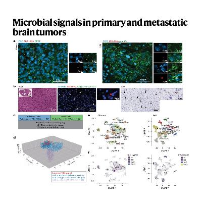 346-脑肿瘤中的微生物信号