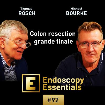 Colon resection - overview and finale by Michael Bourke