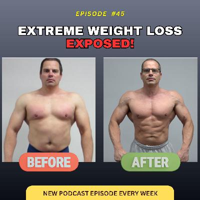Biggest Loser vs. Real Life: Extreme Weight Loss Results