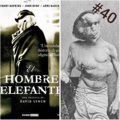 El hombre elefante, la historia de Joseph Merrick.