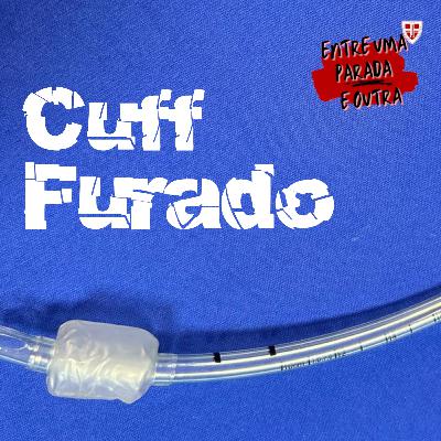 Cuff Furado: O Polêmico ANNEXA 1