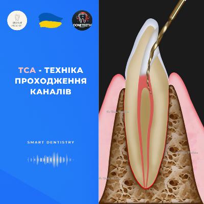 Техніка ТСА. Як зробити складне ендо простим?