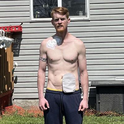 Episode 460: How Cannabis Helped Brenton Crow Overcome Stage 3B Rectal Cancer Episode 460: How Cannabis Helped Brenton Crow Overcome Stage 3B Rectal Cancer