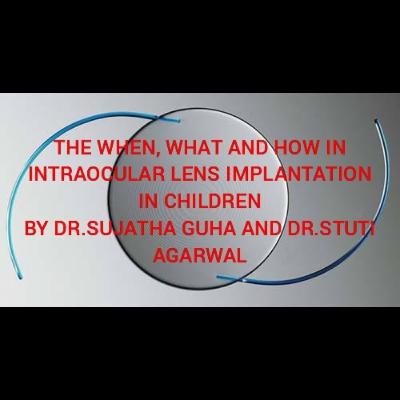 The when,what and how of intraocular lens implantation in children