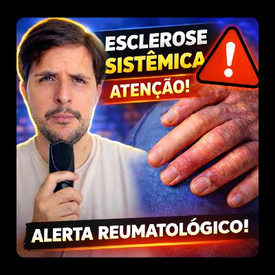 Junta #16 Esclerose Sistêmica: o que é, sintomas, diagnóstico e tratamento Junta #16 Esclerose Sistêmica: o que é, sintomas, diagnóstico e tratamento