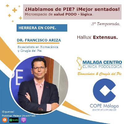Hallux extensus, ¿Hablamos de PIE? ¡Mejor sentados! 29 x 03 |Microespacio de salud podo-LÓGICA (02/07/2025