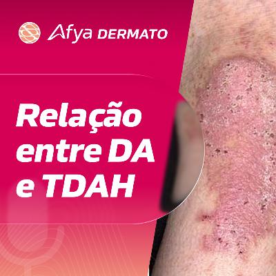 Relação entre DA e TDAH
