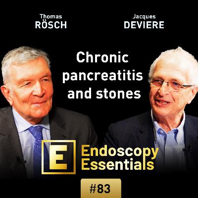Endostherapy of pancreatic duct stones