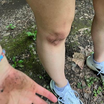 #1 代々木公園で転んで泣きました