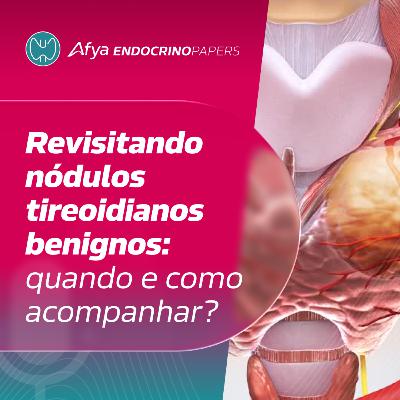 Revisitando nódulos tireoidianos benignos: quando e como acompanhar?