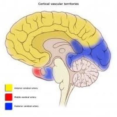 Stroke management: Injury and Rx Plans