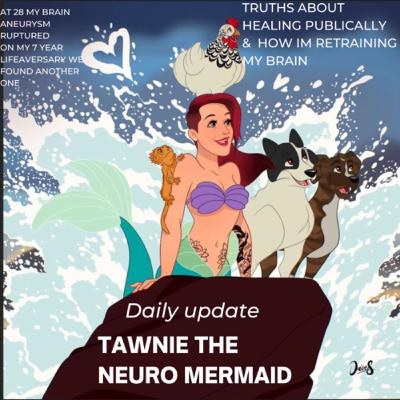 Brain surgery next Monday thoughts & how I managed my migraine & anxiety Brain surgery next Monday thoughts & how I managed my migraine & anxiety