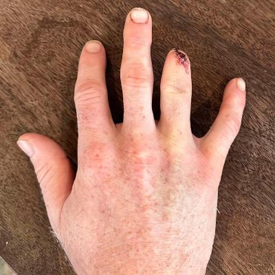 Will Matt Dawson Take His Place In Paris? Plus Five Other Burning Questions