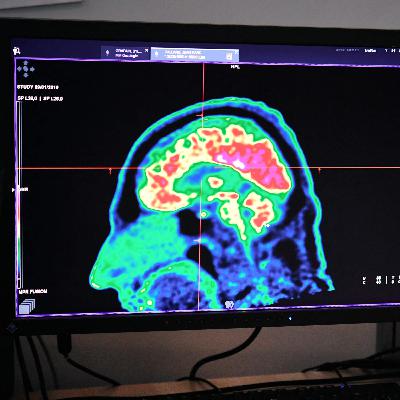 In Good Health: What We Know About ADHD