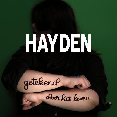 S6 Ep2: Getekend door het leven - Hayden's Story