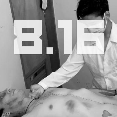 S8E16 - Zombies AmongUs | premature burials & lazarus syndrome S8E16 - Zombies AmongUs | premature burials & lazarus syndrome