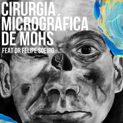 Cirurgia Micrográfica de Mohs com Dr. Felipe Soeiro Cirurgia Micrográfica de Mohs com Dr. Felipe Soeiro