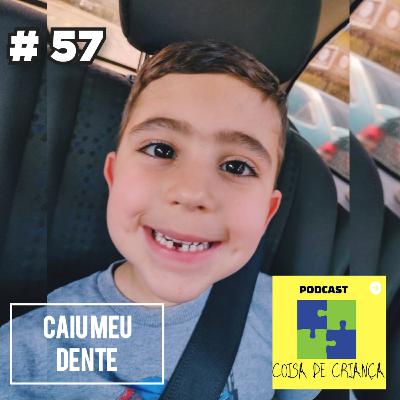 #57 Caiu meu dente
