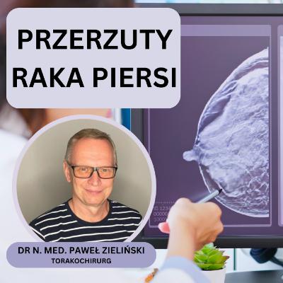 Odcinek 146. Przerzuty raka piersi do płuc. Diagnostyka. Część 1.
