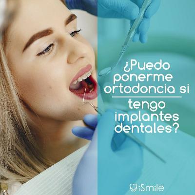 ¿Puedo ponerme ortodoncia si tengo implantes dentales ?