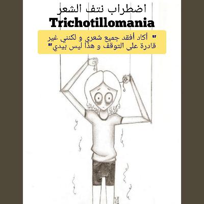 هوس نتف الشعر | Trichotillomania