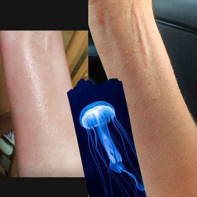 Do we create our pain?