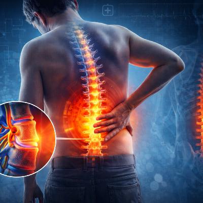 Stufentherapie der Rückenschmerzen Stufentherapie der Rückenschmerzen
