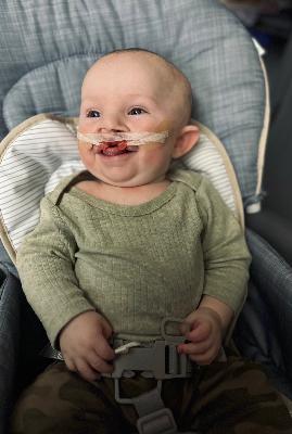 From Diagnosis to Discharge: Zade's Cleft Journey and Lessons in Advocacy with Natalie and Alec