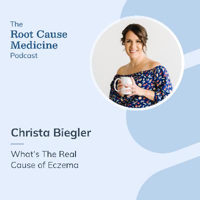 What’s The Real Cause of Eczema with Christa Biegler: Episode Rerun What’s The Real Cause of Eczema with Christa Biegler: Episode Rerun