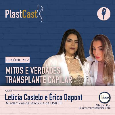 PlastCast #12 | Transplante Capilar