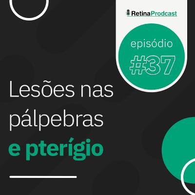 Live #38: Lesões nas pálpebras e pterígio Live #38: Lesões nas pálpebras e pterígio