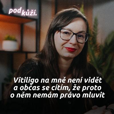 Monika z Vitiligo klub: "Nedokonalost" na tobě musí být pořádně vidět, jinak lidi nezajímáš Monika z Vitiligo klub: "Nedokonalost" na tobě musí být pořádně vidět, jinak lidi nezajímáš