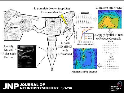 JNP Podcasts: Improving localization and measurements of M-waves using high-density surface electromyography