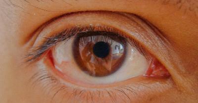 Settimana Mondiale del Glaucoma: l'importanza di controllare la vista anche senza sintomi Settimana Mondiale del Glaucoma: l'importanza di controllare la vista anche senza sintomi