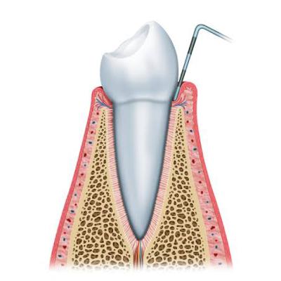 Terapias Periodontais