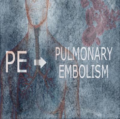 The Prehospital PE The Prehospital PE